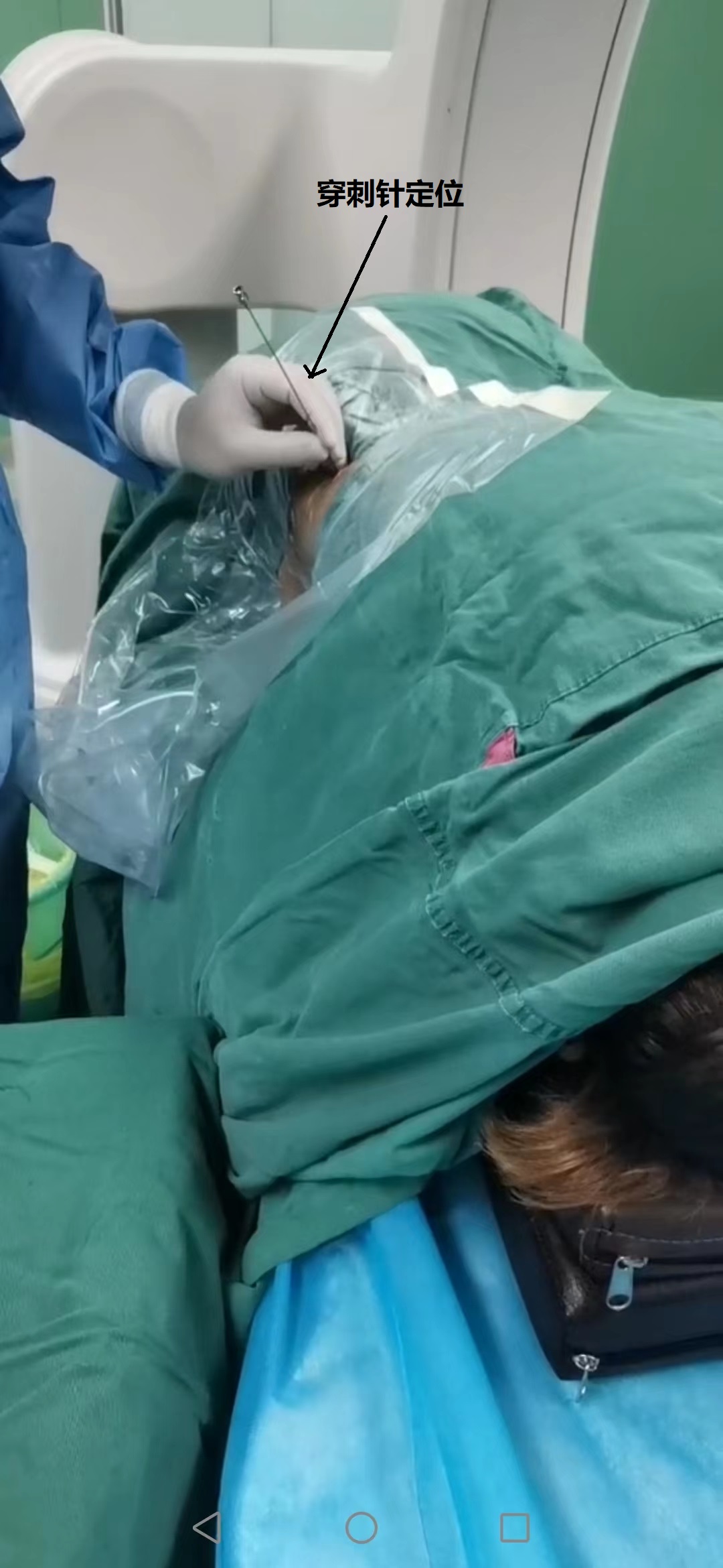 1-穿刺針-定位.jpg